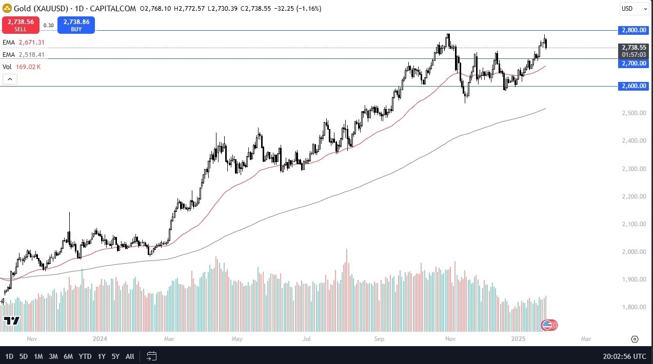 【XM Market Review】--Gold Forecast: Dips Amid Market Uncertainty(图1)